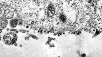 Photo of Homem é diagnosticado com Covid-19, gripe e dengue em Aparecida de Goiânia